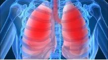 Бронхиальная астма: причины, симптомы, первая помощь