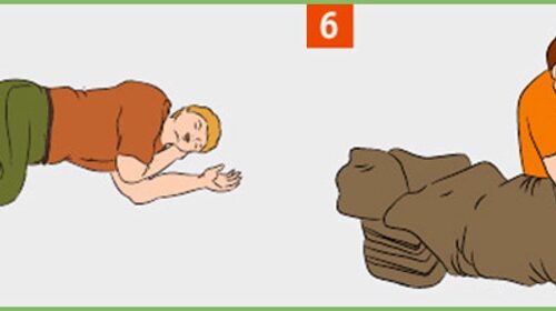 3 Первая помощь при поражении электрическим током