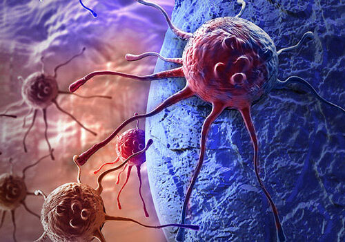 Признаки возможного онкологического заболевания