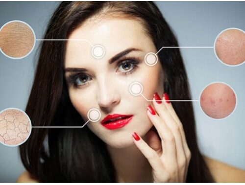 Сахарный диабет и КОЖА