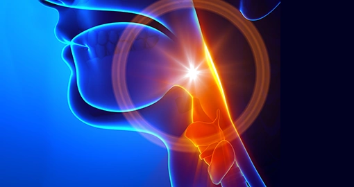 Рак полости рта