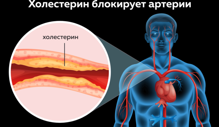 ТОП-7 продуктов снижающих уровень холестерина