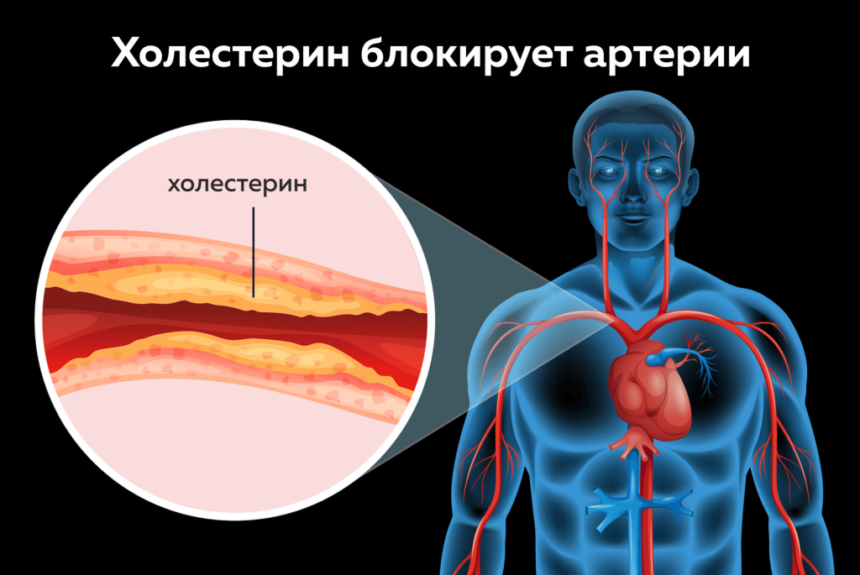 ТОП-7 продуктов снижающих уровень холестерина