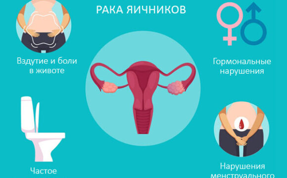 Профилактика рака яичников